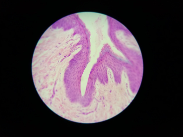Stratified Squamous Epithelium Slides - Stratified Squamous Epithelium 01 400X